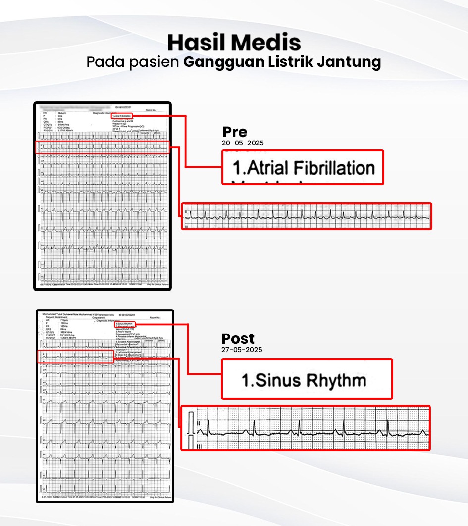 hasi medis